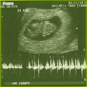 My First Ultrasound